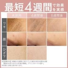 IRIS OHYAMA IRIS MICOLA Light Beauty Device (White) LB-M101-W